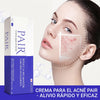 Crema Facial  Para el Acné